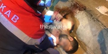 Θεσσαλονίκη: Σοκαριστικές φωτογραφίες από τη ληστεία της Γιαννιτσών – Τον πετσόκοψαν για 50 ευρώ!
