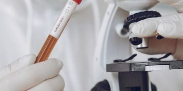 Θεσσαλονίκη: Απείλησαν ιδιοκτήτη διαγνωστικού κέντρου επειδή πουλάει φτηνά το τεστ κορωνοϊού