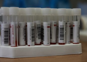 Παπανικολάου: Δωρεάν εξέταση αντισωμάτων SARS CoV-2 στους αιμοδότες