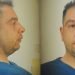 Αυτός είναι ο 38χρονος που κατηγορείται για τον βιασμό τριών γυναικών στη Θεσσαλονίκη