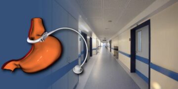 Από τι πέθανε 14χρονη που έβαλε γαστρικό δακτύλιο