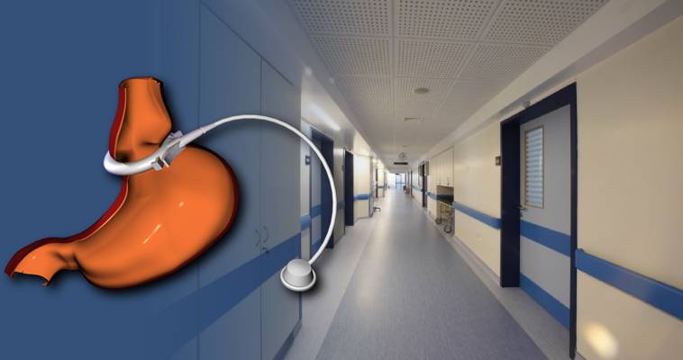 Από τι πέθανε 14χρονη που έβαλε γαστρικό δακτύλιο