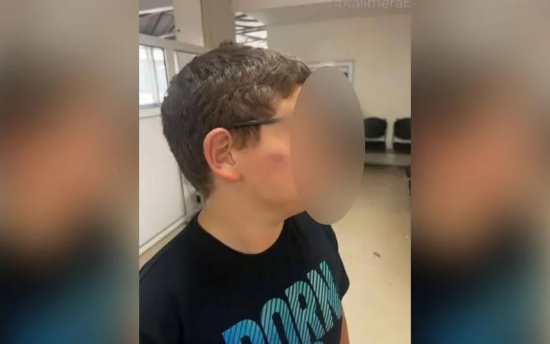 Θεσσαλονίκη: Άγριο ξύλο σε 11χρονο στο σχολείο του – Συγκλονίζει η μητέρα του